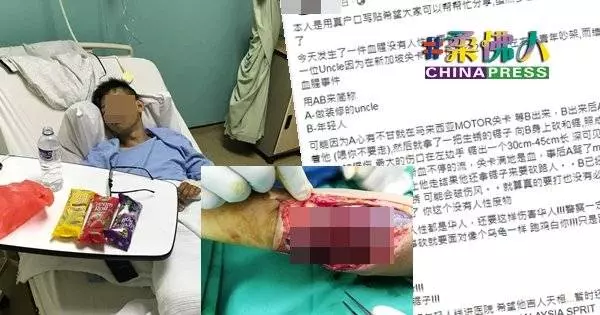 看一眼 引爭執 華青大動脈被砍斷