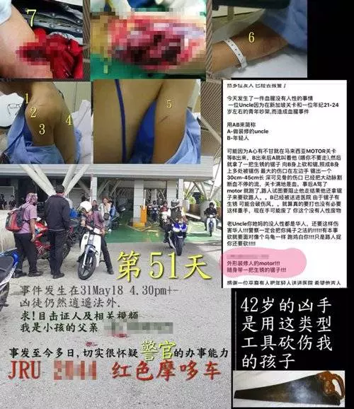 看一眼 引爭執 華青大動脈被砍斷