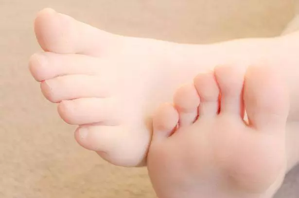 腳上有這4種特徵的,不分男女,早晚能發大財,註定是有錢人
