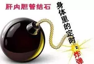 國醫大師:2個神奇「排石藥方」,2個竅門應對膽絞痛,常喝4碗湯,遠離膽結石