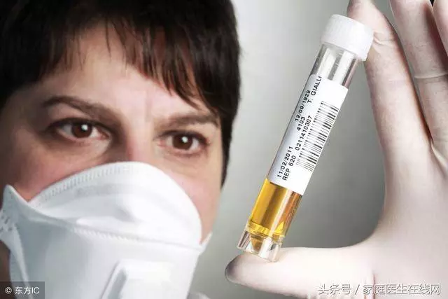 女人尿尿時,發現尿液很黃?身體在跟你「報告」這5件事
