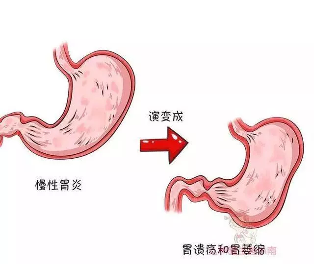 你還經常親吻寶寶? 小心病從口出