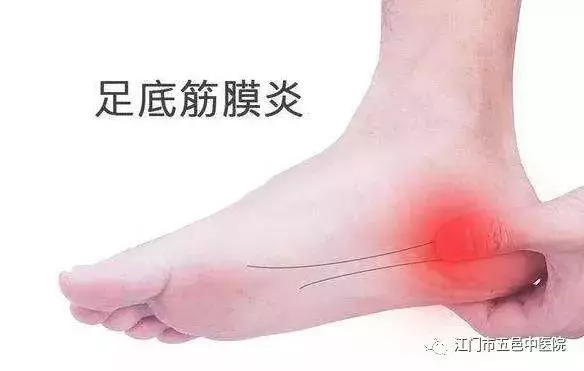 走路腳跟疼,像踩到釘子一樣?這病惹禍,簡單四招幫你遠離疼痛