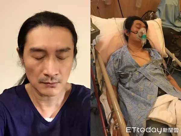 一旅外國人欠健保費2.5萬 回台看病用掉72萬醫療資源,黃安條款快通過吧