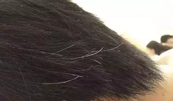 白頭發過多,多吃這十種食物