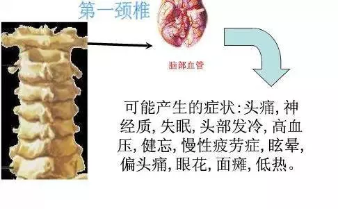 手麻、頭暈、頭痛…你有沒有想過其實是頸椎問題?趕緊看看自己到了第幾級頸椎問題吧! 頸椎病的10個級別,你在哪一級?