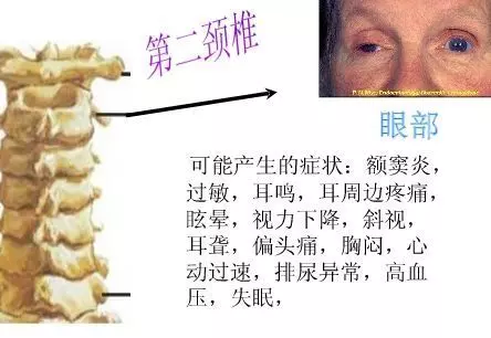 手麻、頭暈、頭痛…你有沒有想過其實是頸椎問題?趕緊看看自己到了第幾級頸椎問題吧! 頸椎病的10個級別,你在哪一級?