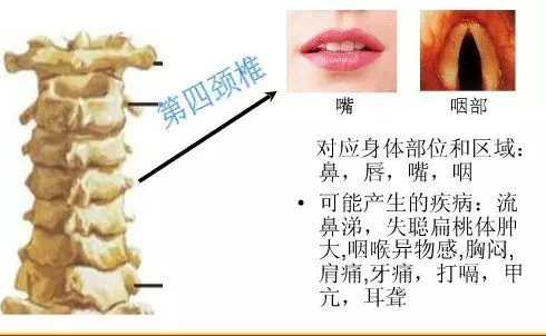 手麻、頭暈、頭痛…你有沒有想過其實是頸椎問題?趕緊看看自己到了第幾級頸椎問題吧! 頸椎病的10個級別,你在哪一級?