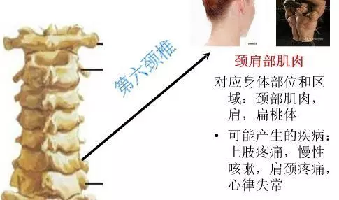 手麻、頭暈、頭痛…你有沒有想過其實是頸椎問題?趕緊看看自己到了第幾級頸椎問題吧! 頸椎病的10個級別,你在哪一級?