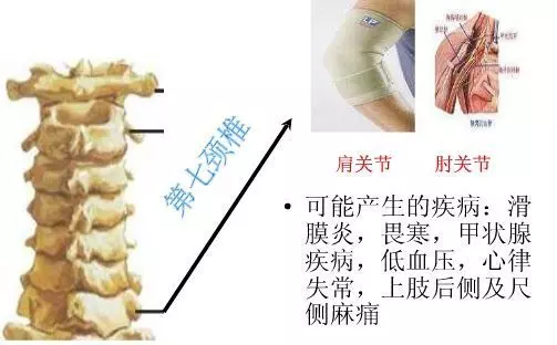 手麻、頭暈、頭痛…你有沒有想過其實是頸椎問題?趕緊看看自己到了第幾級頸椎問題吧! 頸椎病的10個級別,你在哪一級?