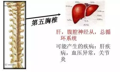 手麻、頭暈、頭痛…你有沒有想過其實是頸椎問題?趕緊看看自己到了第幾級頸椎問題吧! 頸椎病的10個級別,你在哪一級?