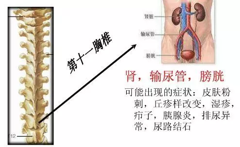 手麻、頭暈、頭痛…你有沒有想過其實是頸椎問題?趕緊看看自己到了第幾級頸椎問題吧! 頸椎病的10個級別,你在哪一級?