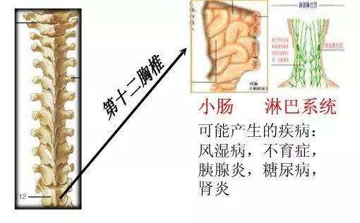 手麻、頭暈、頭痛…你有沒有想過其實是頸椎問題?趕緊看看自己到了第幾級頸椎問題吧! 頸椎病的10個級別,你在哪一級?