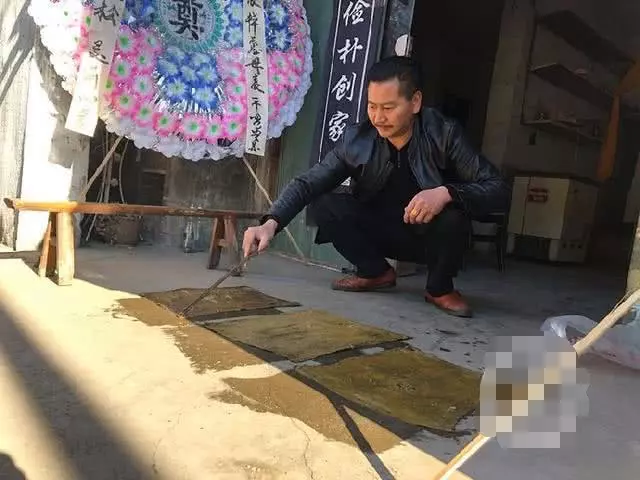 女子引產手術後,腹痛146天死亡,腹中取出3塊「黑團」