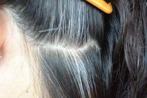 人未老頭髮已花白?原來是你的身體缺乏這些營養素!「這樣做」就能改善,白髮變回黑髮!