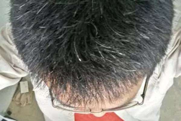 人未老頭髮已花白?原來是你的身體缺乏這些營養素!「這樣做」就能改善,白髮變回黑髮!