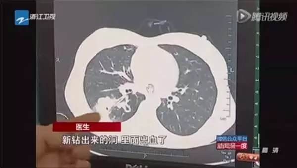 他們把小龍蝦放在超音波清洗機中…結果震出來的東西恐怖到令人頭皮發麻