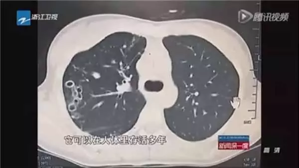 他們把小龍蝦放在超音波清洗機中…結果震出來的東西恐怖到令人頭皮發麻