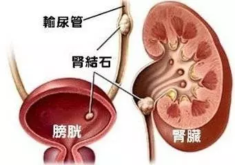 尿頻尿痛尿急,那是泌尿系感染了,一種常見的草,連吃三天幫你改善疼痛!