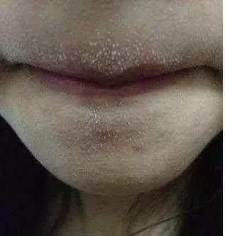 請注意發現肝病前,身體會出現容易辨認的徵兆,一旦出現請到醫院檢查
