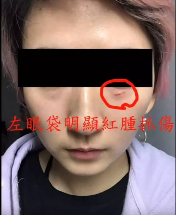 澳洲打工遇「台灣人欺壓台灣人」拿不到薪水 上網怒揭「對方動手耍流氓」還有更惡劣的