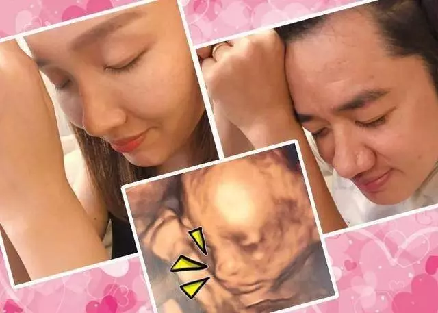 李亞男王祖藍女兒Gabrielle降臨,看見寶寶的樣子,網友: 我擔心的事情開始發生了