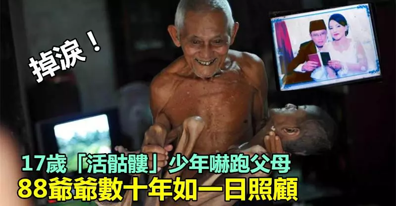 掉淚!17歲「活骷髏」少年嚇跑父母,88爺爺數十年如一日照顧!!