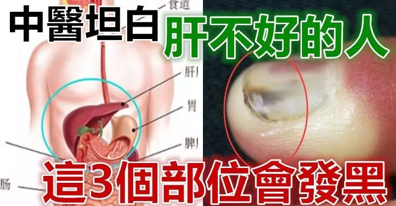 中醫坦白:肝不好的人,這3個部位會發黑!秋季多吃3種改善肝功能的食物