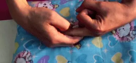 14組最直接的穴位養生方法,快速學會如何利用穴位自治,超簡單