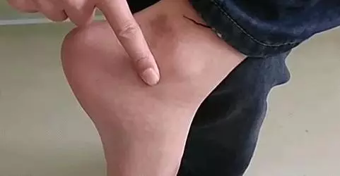 14組最直接的穴位養生方法,快速學會如何利用穴位自治,超簡單