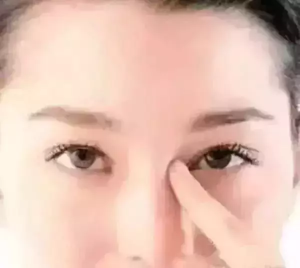 五個穴位是去眼袋的幫手,按一按很有效,快學起來吧!