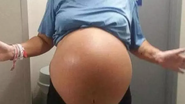 50歲孕婦感覺懷的不是嬰兒,生產時,醫生剖開孕婦肚子情緒失控!