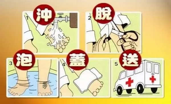 兒童燙傷、劃傷、扭傷、流鼻血的急救處理誤區