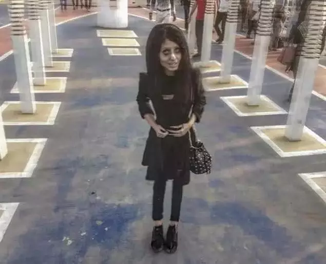 20歲少女整容失敗成殭屍臉,卻意外走紅,網友:現實版殭屍新娘