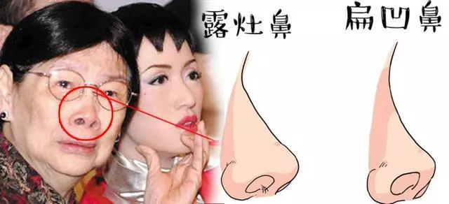 三種鼻子一生【難富貴】,希望你沒有!