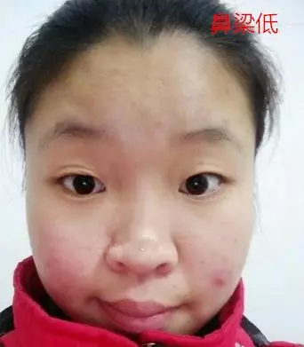 三種鼻子一生【難富貴】,希望你沒有!