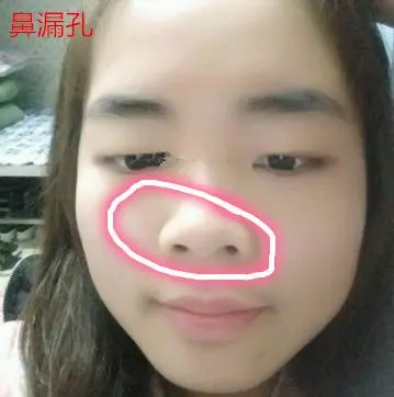 三種鼻子一生【難富貴】,希望你沒有!