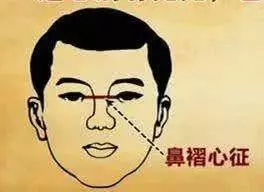心臟不好的人,臉上會有這4種表現,趕緊去檢查吧!
