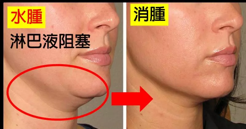 大圓臉不是胖是「水腫」!一秒學會「淋巴暢流按摩法」秒退水腫,雙下巴、泡泡眼自然消,「瓜子臉」迅速現形!