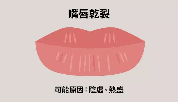 看唇色秒懂健康,中醫教你如何改善自身狀況