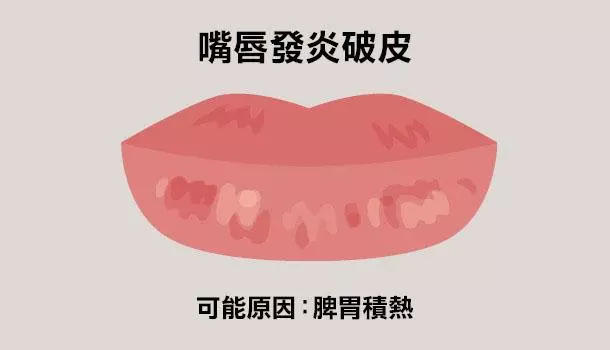 看唇色秒懂健康,中醫教你如何改善自身狀況