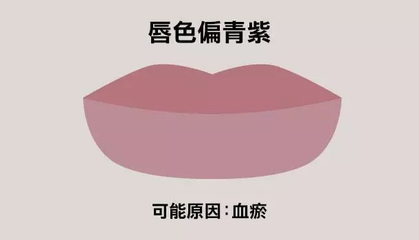 看唇色秒懂健康,中醫教你如何改善自身狀況