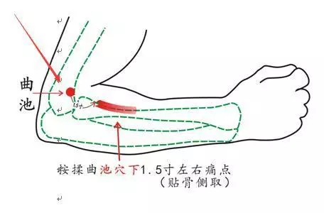 皮膚濕疹總不好?中醫主任:這4個巧方法,相互結合,濕疹全消