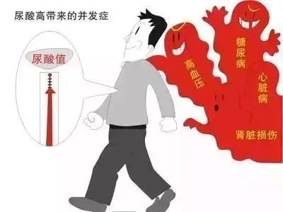 高尿酸和痛風的注意:哪些能吃,哪些不能吃,一張表格都告訴你!
