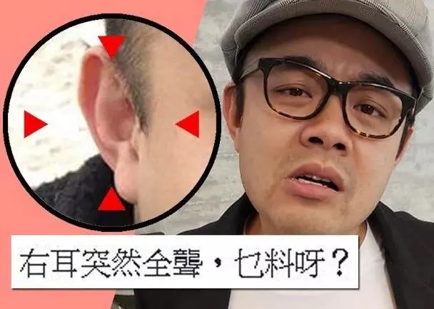 右耳突然完全失聰! 39歲男藝人自爆一天工作22小時:太累