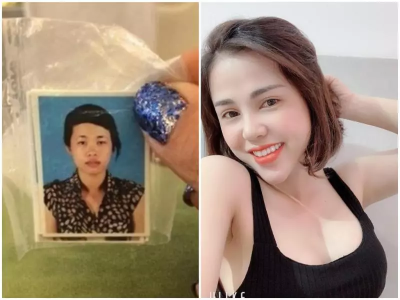 單親媽醜到被退婚 砸 13 萬整型如今正到讓人流口水