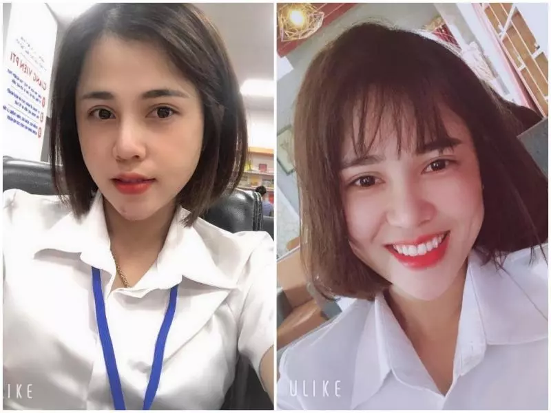 單親媽醜到被退婚 砸 13 萬整型如今正到讓人流口水