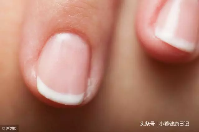肝好不好,看這些地方有沒有「變黑」!枸杞換一種吃法最養肝