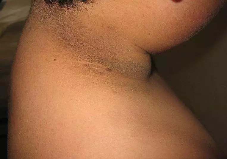 女孩脖子上有一圈洗不掉的髒汙,去檢查時醫生的話嚇壞了大家,紛紛檢查自己有沒有!