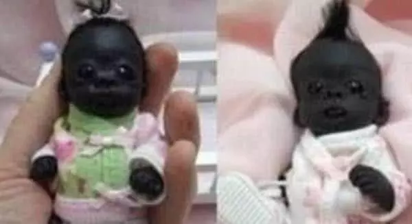 曾經紅遍網路的「世界上最黑嬰兒」，三年後的今天怎麼樣了